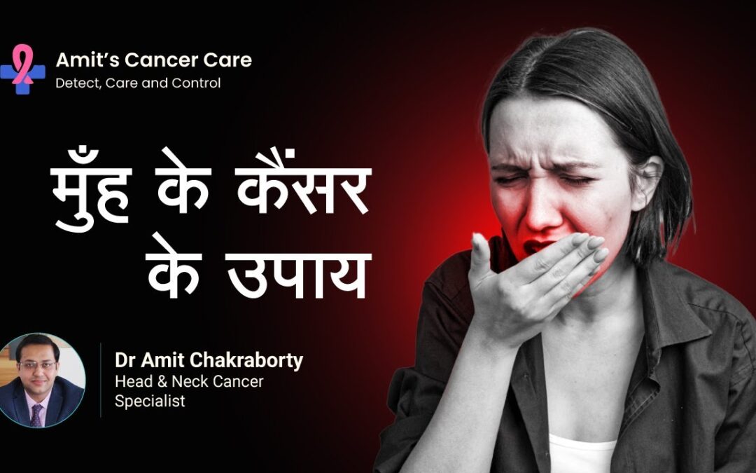 Treatment for Mouth cancer
