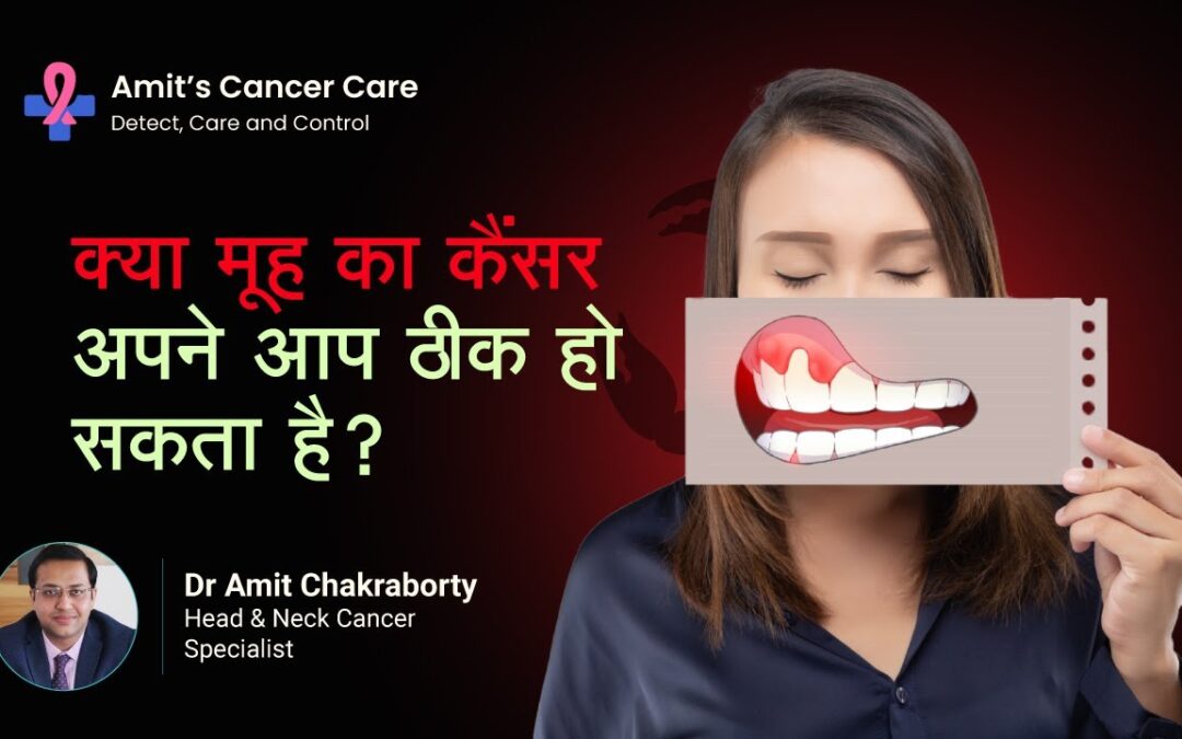 Can Mouth Cancer Get Cured on Its Own?