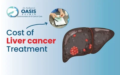 What is the Cost of Liver Cancer Treatment in India?