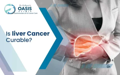 Is Liver Cancer Curable?
