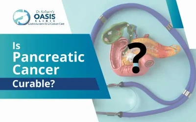Is Pancreatic Cancer Curable?