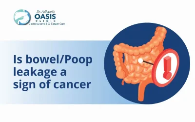 Is Bowel/Poop Leakage A Sign Of Cancer