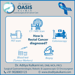 Test-to-diagnose-Rectal-Cancer