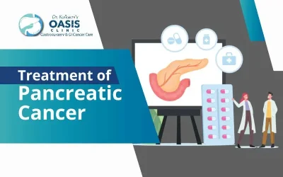 Treatment Options for Pancreatic Cancer