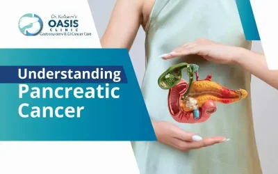 Understanding Pancreatic Cancer