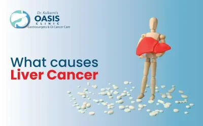 What causes Liver Cancer?