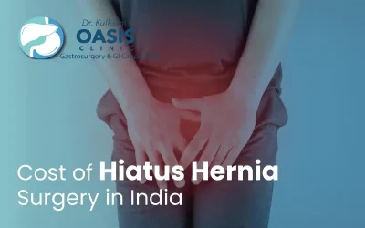 What Is The Cost Of Hiatus Hernia Surgery In India?