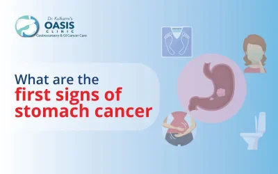 What Is The First Sign Of Stomach Cancer?