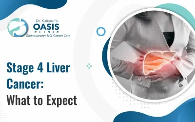 Stage 4 Liver Cancer: What to Expect