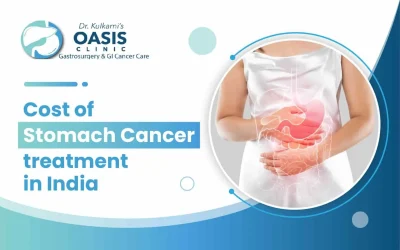 What Is The Cost Of Stomach Cancer Treatment In India?