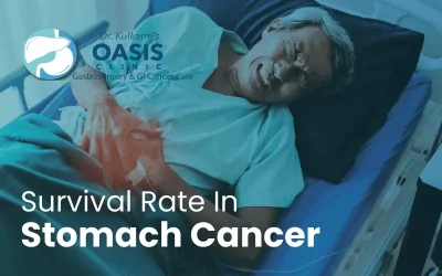 What Are The Survival Rate In Stomach Cancer?