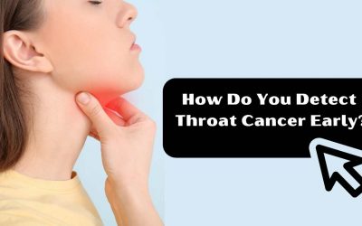 How Do You Detect Throat Cancer Early?