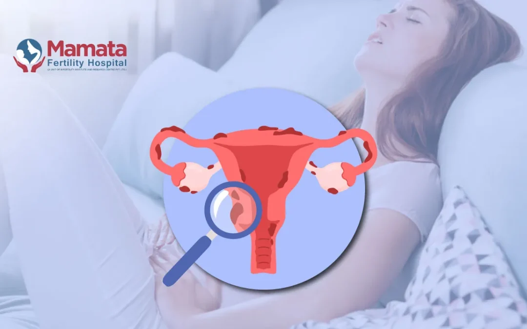 Can Endometriosis Come Back After Surgery?