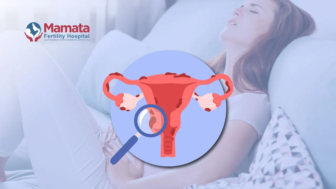 Endometriosis Come Back After Surgery