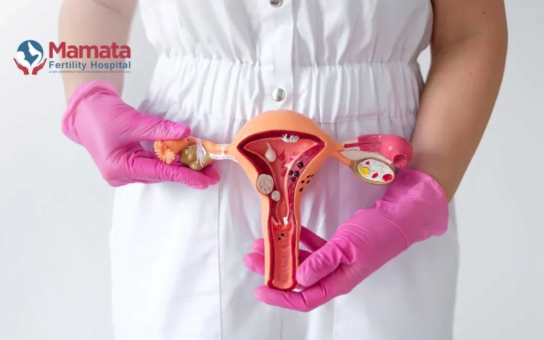 Difference Between Endometriosis and Ovarian Cyst