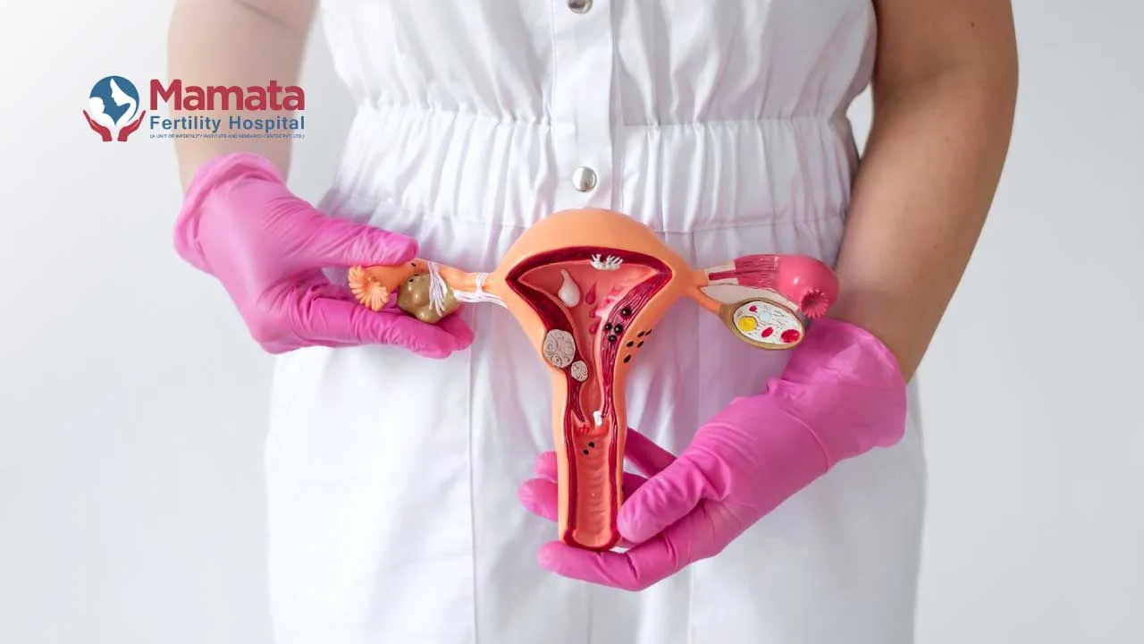 difference-between-endometriosis-and-ovarian-cyst Difference Between Endometriosis and Ovarian Cyst