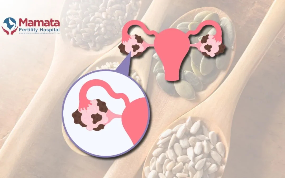 Seed Cycling for PCOS: Is It Worth It?