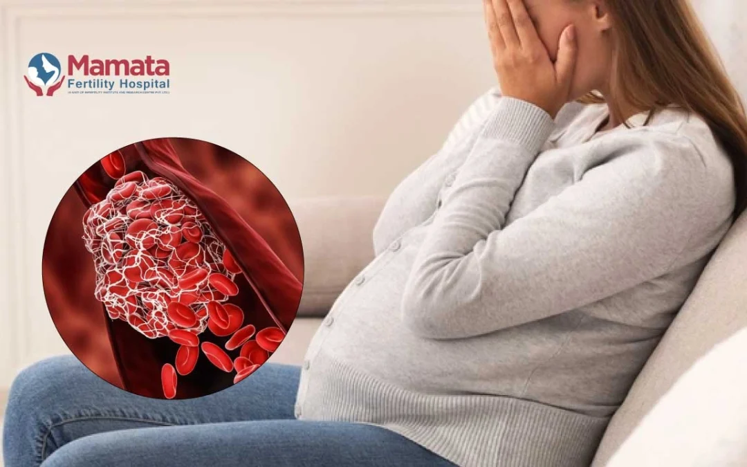 Understanding Your Risk for Blood Clots with Pregnancy