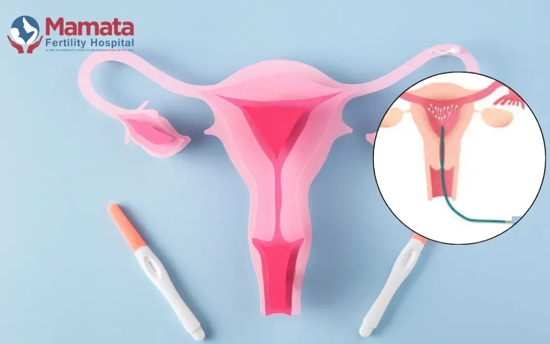 Pregnancy Test After IUI