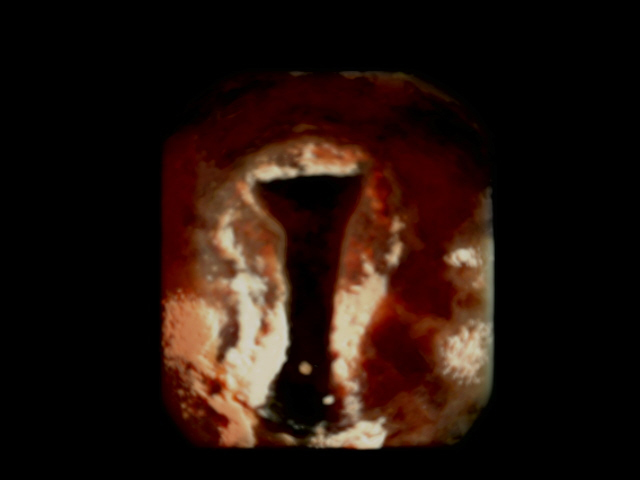 3d-1