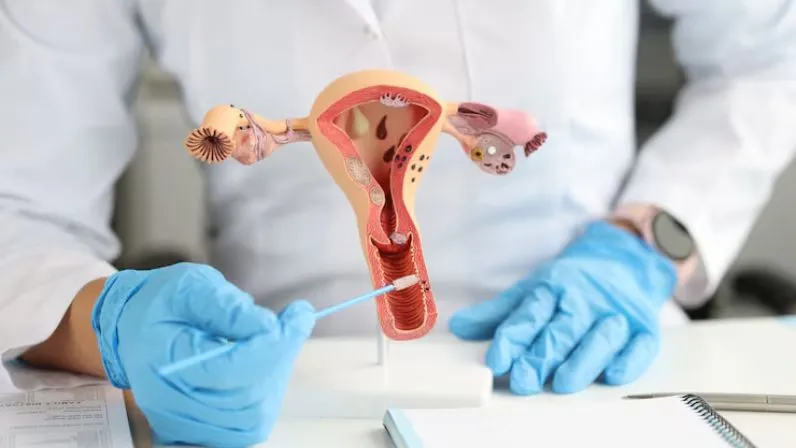 Azoospermia