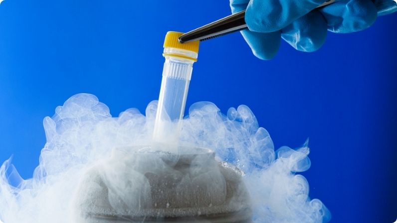 Cryopreservation