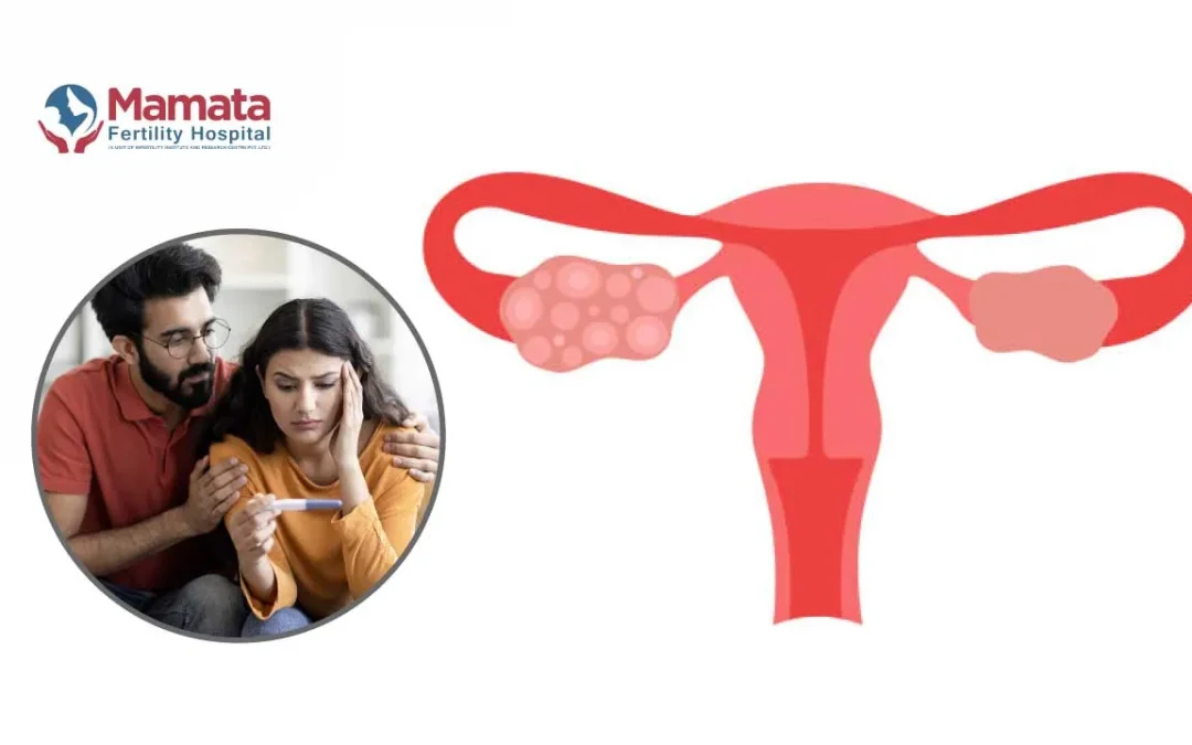 Does PCOS Cause Infertility? Causes, Treatment & Pregnancy Chances