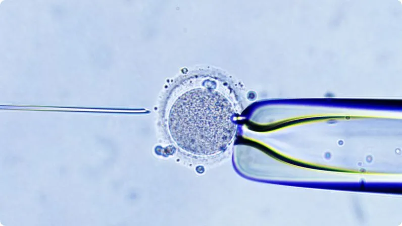 Azoospermia