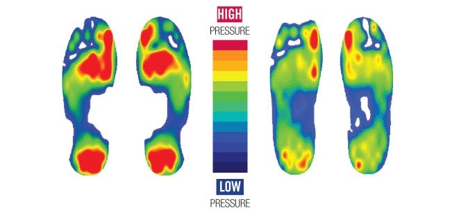 Image result for diabetic foot care podiascan