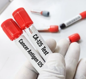 Comprehensive Cancer Screening Package